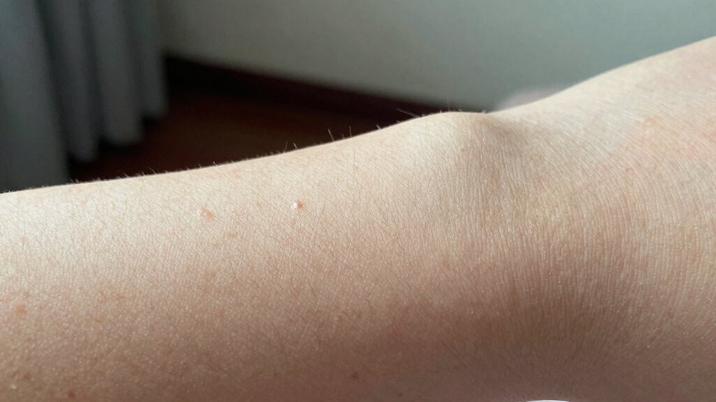 evolutionary hair raising reflex